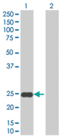 SFRS2 293T Cell Overexpression Lysate (Denatured), Abnova 100 &mu;L | Buy Online | Abnova | Fisher Scientific