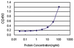 anti-SFTPB Matched Antibody Pair, Abnova 1 Set, Unlabeled:Antibodies, Monoclonal/Polyclonal