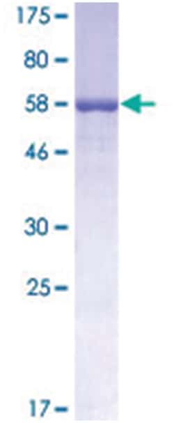 Abnova SFTPB Recombinant Protein 10 &mu;g | Buy Online | Abnova&trade; | Fisher Scientific