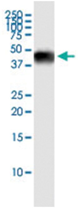 anti-SFTPB, Human, IP-WB Antibody Pair, Abnova 1 Set:Antibodies, Monoclonal/Polyclonal