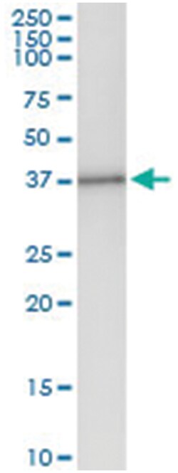 anti-SGCD, Human, IP-WB Antibody Pair, Abnova™