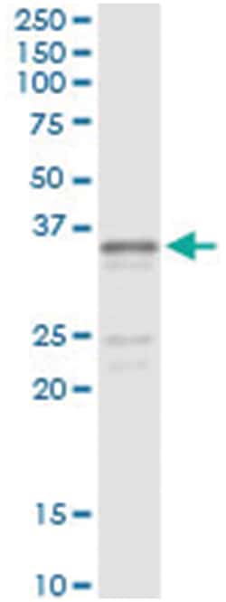 SGCG, Human, IP-WB Antibody Pair (PW2), Abnova&trade;