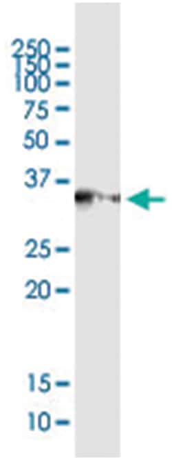 SGCG, Human, IP-WB Antibody Pair (PW3), Abnova&trade;