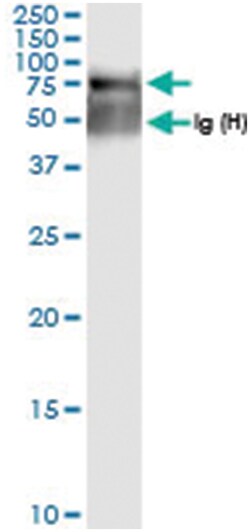 anti-SGSH, Human, IP-WB Antibody Pair, Abnova™