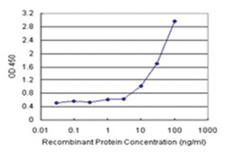 anti-SGTA Matched Antibody Pair, Abnova
