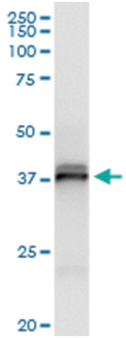 SGTA, Human, IP-WB Antibody Pair (PW3), Abnova&trade;