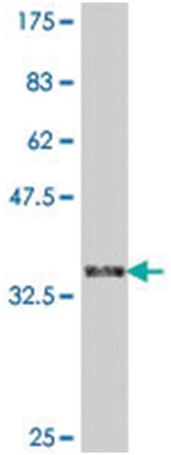 FBXW4, Mouse, Polyclonal Antibody, Abnova 50 &mu;L | Buy Online | Abnova | Fisher Scientific