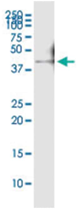 anti-SHOX2, Human, IP-WB Antibody Pair, Abnova 1 Set:Antibodies, Monoclonal/Polyclonal