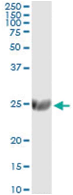 Abnova anti-ST6GAL1, Human, IP-WB Antibody Pair, Abnova™
