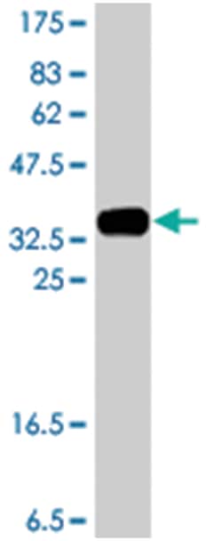 SKP2, Mouse, Polyclonal Antibody, Abnova 50&mu;L; Unlabeled:Antibodies,