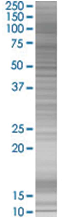 SLC4A1 293T Cell Overexpression Lysate (Denatured), Abnova 100 &mu;L | Buy Online | Abnova | Fisher Scientific