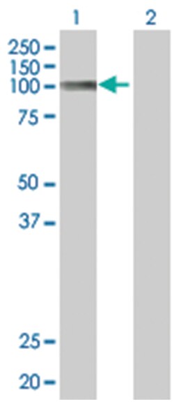 SLC4A1 293T Cell Overexpression Lysate (Denatured), Abnova 100 &mu;L | Buy Online | Abnova | Fisher Scientific