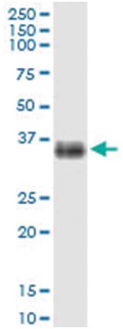 anti-SLC14A1, Human, IP-WB Antibody Pair, Abnova™