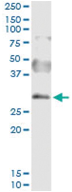 anti-SNAI2, Human, IP-WB Antibody Pair, Abnova™
