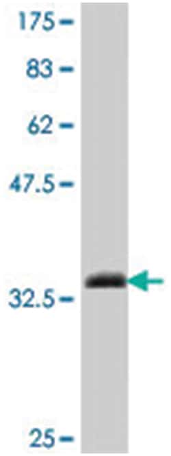SMARCA2, Mouse, Polyclonal Antibody, Abnova 50&mu;L; Unlabeled:Antibodies,