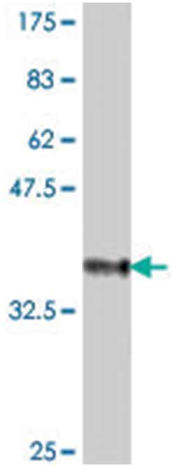 SMARCB1, Mouse, Polyclonal Antibody, Abnova 50&mu;L; Unlabeled:Antibodies,