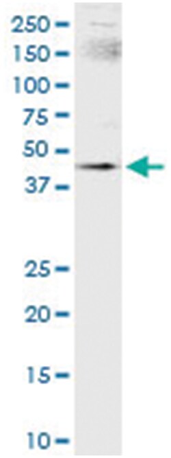 anti-SMARCB1, Human, IP-WB Antibody Pair, Abnova 1 Set:Antikroppar