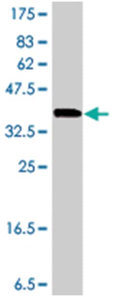 anti-SMN2 Ab-2, Polyclonal, Abnova 50&mu;L; Unlabeled:Antibodies, Polyclonal
