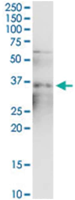 anti-SMN2, Human, IP-WB Antibody Pair, Abnova 1 Set:Antibodies, Monoclonal/Polyclonal