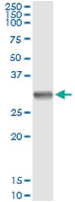 SNAI1, Human, IP-WB Antibody Pair (PW1), Abnova&trade;
