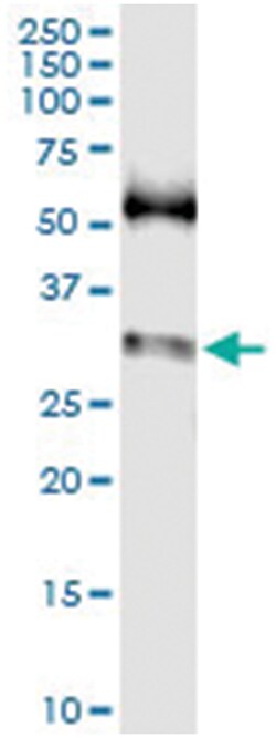SNAI1, Human, IP-WB Antibody Pair (PW2), Abnova&trade;