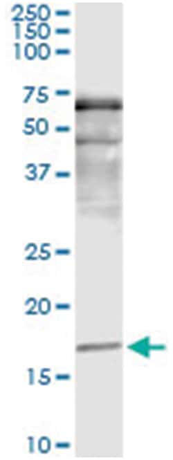 anti-SNCA, Human, IP-WB Antibody Pair, Abnova 1 Set:Antibodies, Monoclonal/Polyclonal