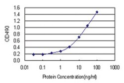 anti-SNCG Matched Antibody Pair, Abnova&trade;