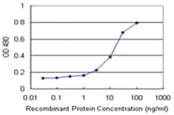 anti-SNRPA Matched Antibody Pair, Abnova 1 Set, Unlabeled:Antibodies, Monoclonal/Polyclonal