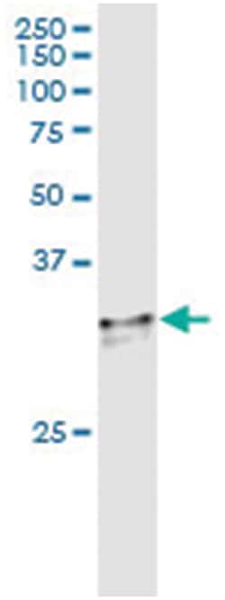 anti-SNRPA, Human, IP-WB Antibody Pair, Abnova™