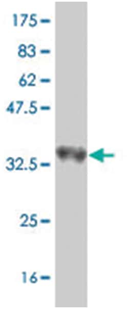 SNRPB, Mouse, Polyclonal Antibody, Abnova 50 &mu;L | Buy Online | Abnova Corporation | Fisher Scientific