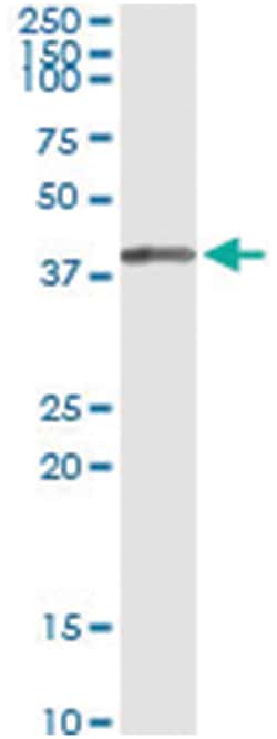Abnova anti-SORD, Human, IP-WB Antibody Pair, Abnova™