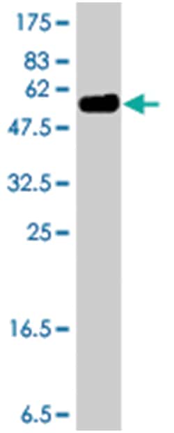 SOX15, Mouse, Polyclonal Antibody, Abnova 50&mu;L; Unlabeled:Anticuerpos