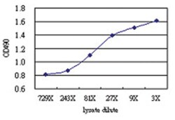 anti-SP100 Matched Antibody Pair, Abnova&trade;