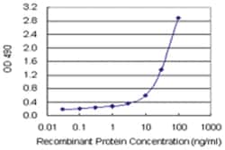 SPP1, Human, Matched Antibody Pair (AP41), Abnova™