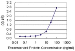 SPP1, Human, Matched Antibody Pair (AP45), Abnova™