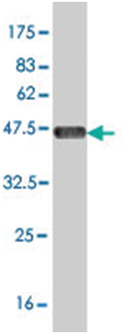 SPP1, Mouse, Clone: 3G11, Abnova 200&mu;L; Unlabeled:Antibodies, Monoclonal