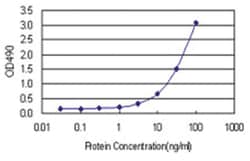 SPR, Human, Matched Antibody Pair (AP21), Abnova 1 set, Unlabeled:Antibodies,