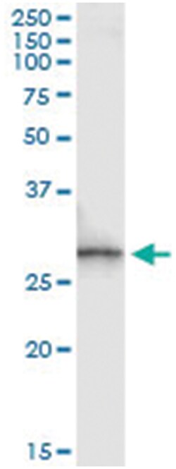 SPR, Human, IP-WB Antibody Pair (PW1), Abnova™