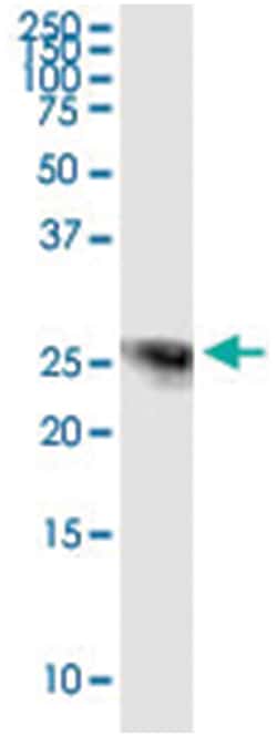 SPR, Human, IP-WB Antibody Pair (PW3), Abnova&trade;