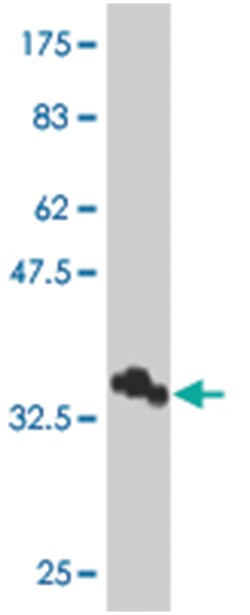 SPTBN2, Mouse, Polyclonal Antibody, Abnova 50&mu;L; Unlabeled:Antibodies,