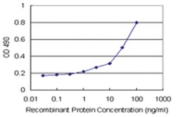 anti-AKR1D1 Matched Antibody Pair, Abnova 1 Set:Antistoffer