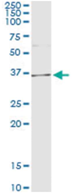 anti-AKR1D1, Human, IP-WB Antibody Pair, Abnova&trade;