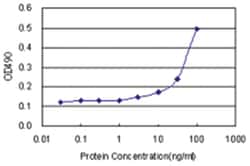 anti-SRPK1 Matched Antibody Pair, Abnova 1 set, Unlabeled:Antibodies, Monoclonal/Polyclonal