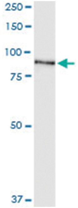 anti-SRPK1, Human, IP-WB Antibody Pair, Abnova&trade;