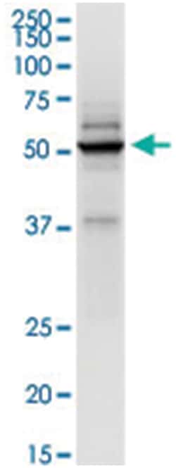 anti-TRIM21, Human, IP-WB Antibody Pair, Abnova 1 Set:Antibodies, Monoclonal/Polyclonal