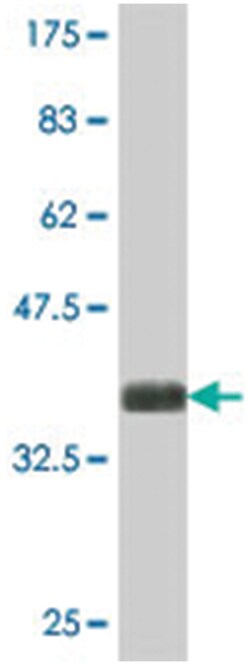 TROVE2, Mouse, Polyclonal Antibody, Abnova 50 &mu;L | Buy Online | Abnova | Fisher Scientific