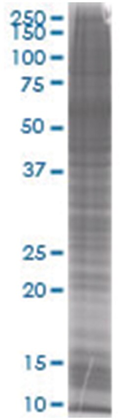SSTR2 293T Cell Overexpression Lysate (Denatured), Abnova 100 &mu;L | Buy Online | Abnova | Fisher Scientific