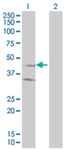 SSTR2 293T Cell Overexpression Lysate (Denatured), Abnova 100 &mu;L | Buy Online | Abnova | Fisher Scientific