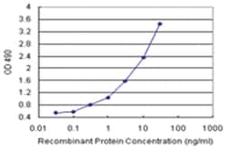 anti-SSX2 Matched Antibody Pair, Abnova