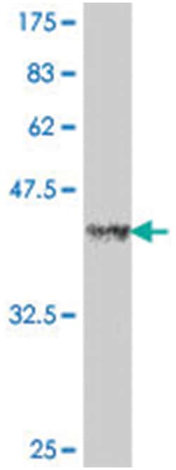 ST14, Mouse, Polyclonal Antibody, Abnova 50&mu;L; Unlabeled:Antibodies,